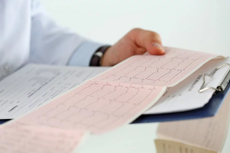 Read more about the article Arrhythmia