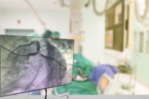 Coronary Angiogram Catheterization