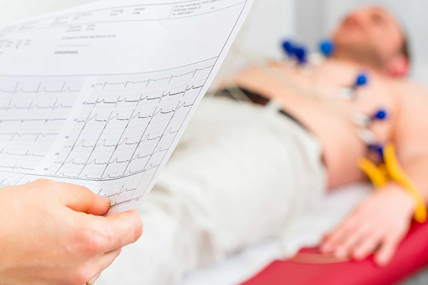 Read more about the article Electrocardiogram (ECG)