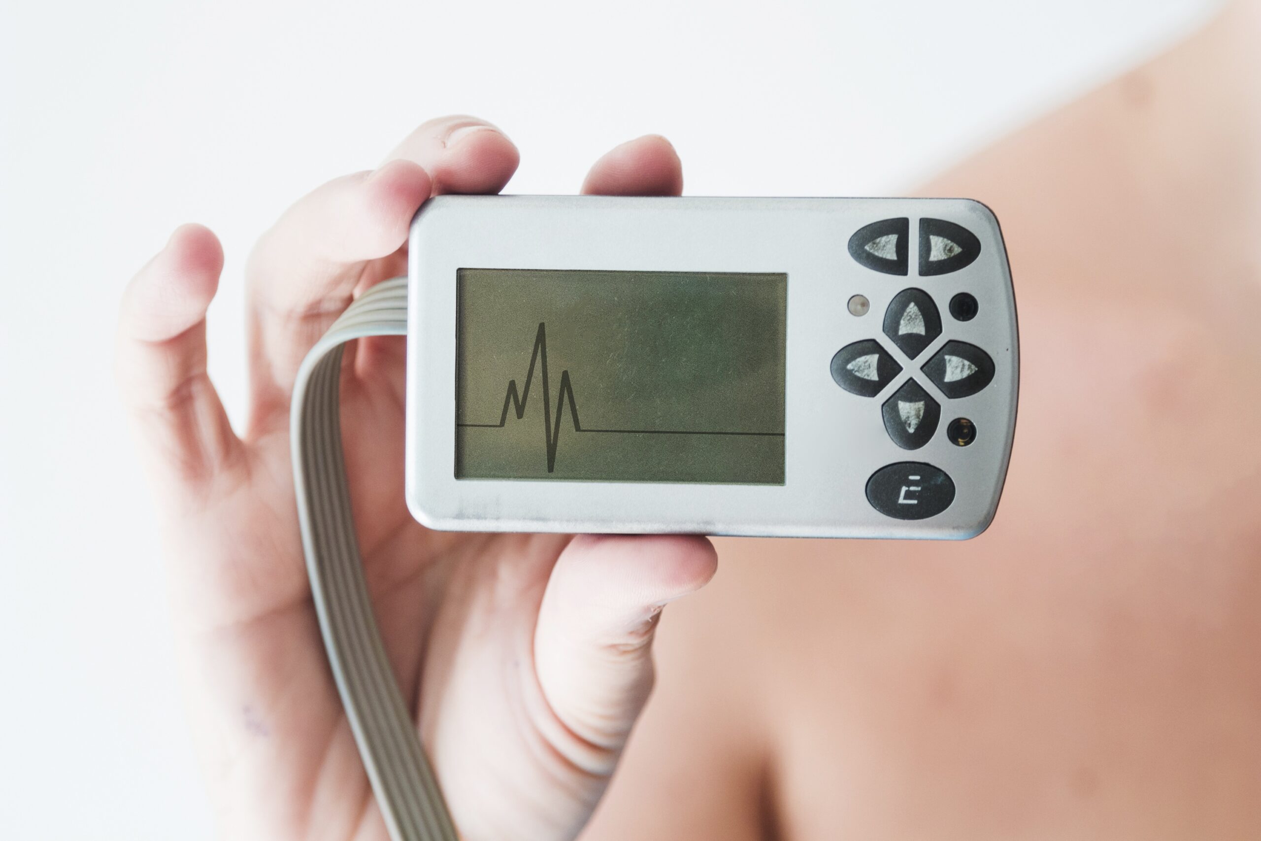 Read more about the article What Can a Holter ECG Reveal About Your Heartbeat During Sleep, Exercise and Everyday Activities?